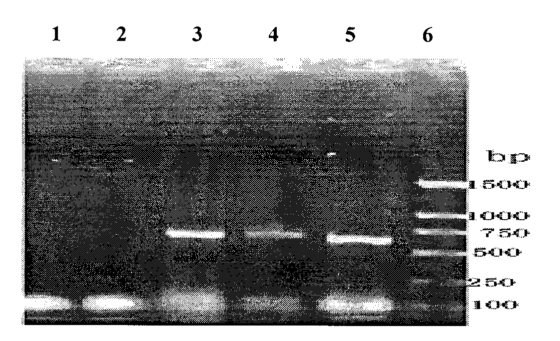 B-cell epitope of human melanoma antigen MAGE-A3 and application thereof