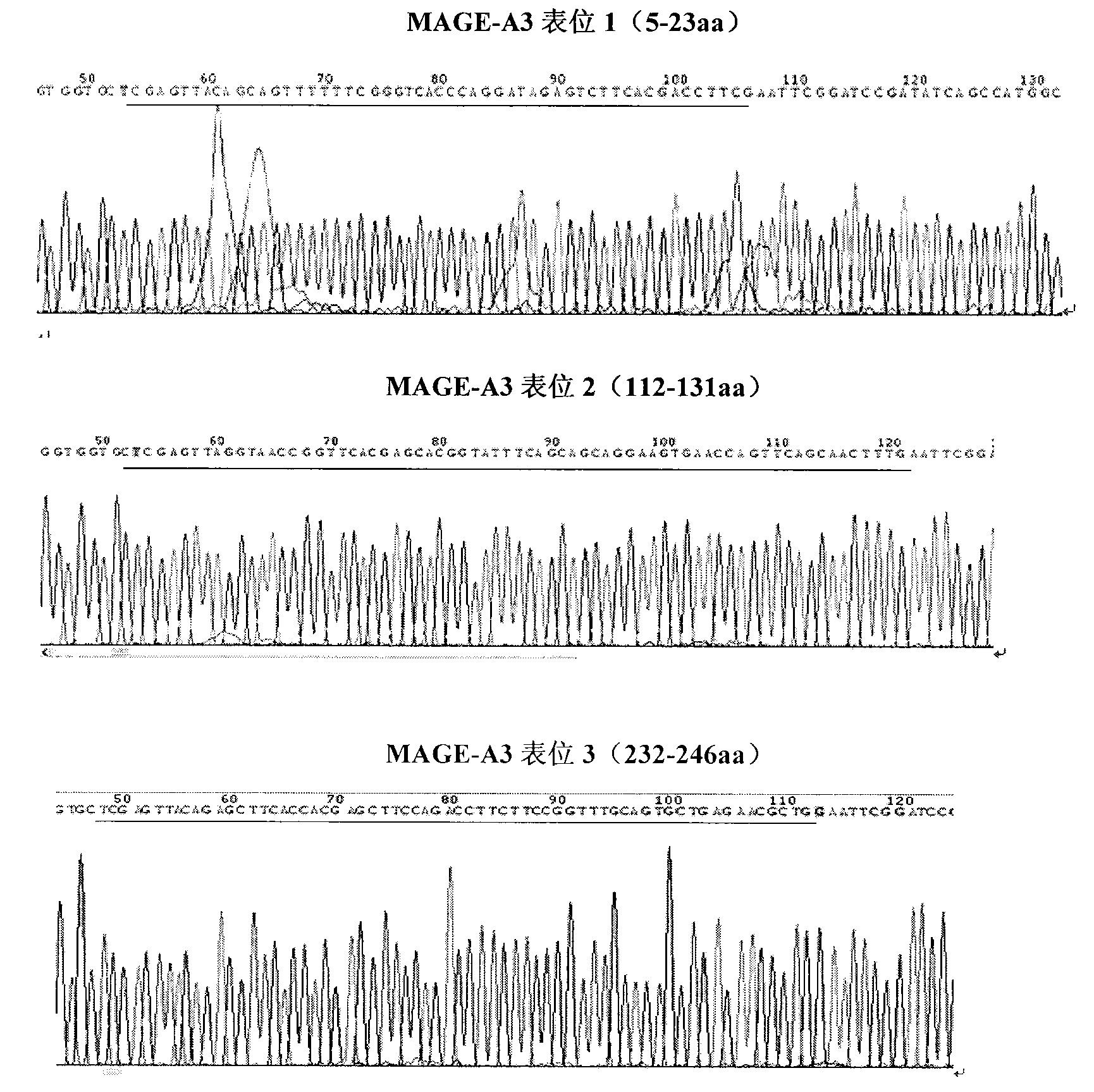 B-cell epitope of human melanoma antigen MAGE-A3 and application thereof