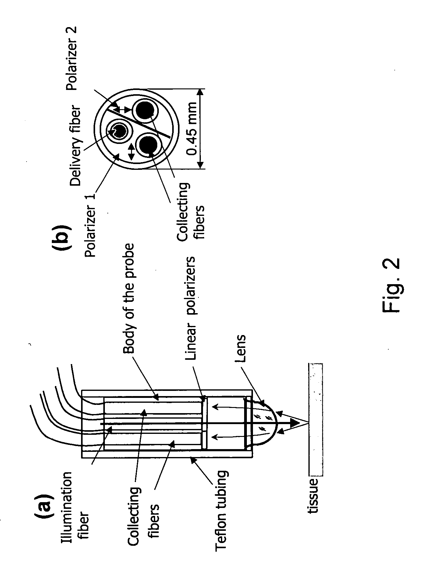 Method of recognizing abnormal tissue using the detection of early increase in microvascular blood content