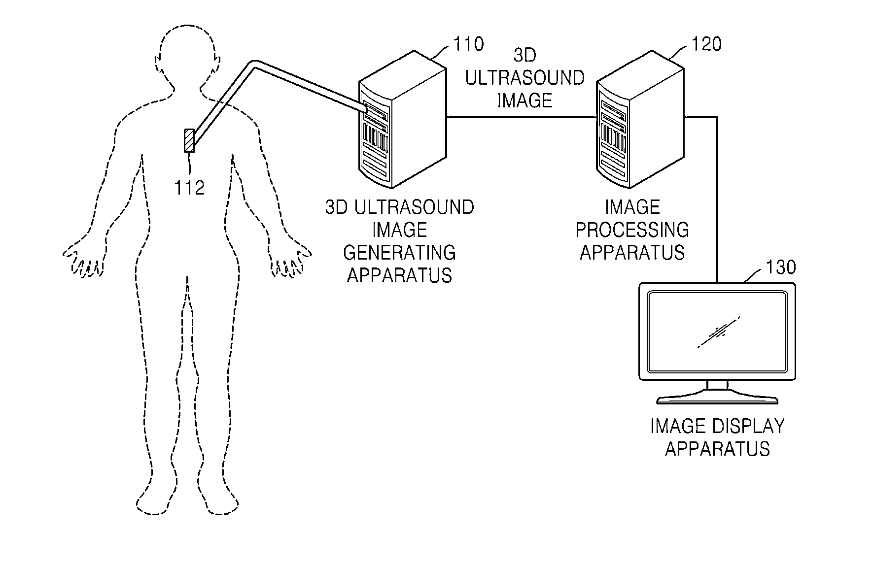 Method and apparatus for processing ultrasound image