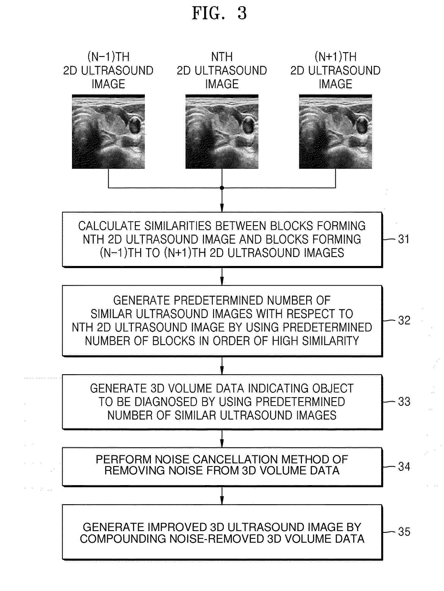 Method and apparatus for processing ultrasound image