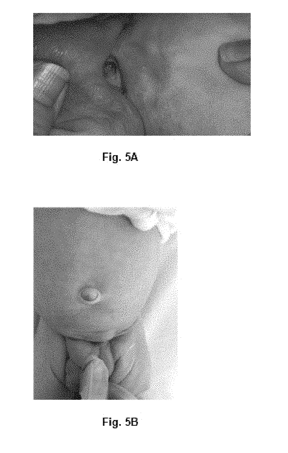 Compositions for the treatment of ischemic ulcers and stretch marks