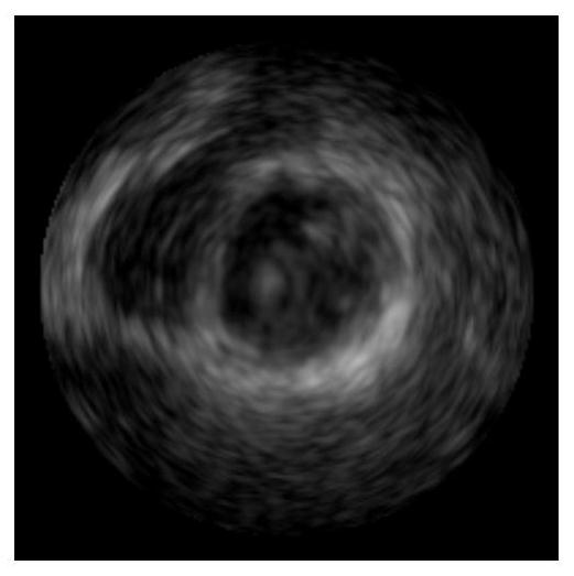 Echocardiographic Ventricle Segmentation Method and Device Based on Deep Learning and Deformable Model