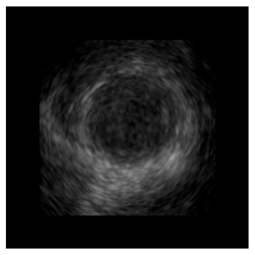 Echocardiographic Ventricle Segmentation Method and Device Based on Deep Learning and Deformable Model