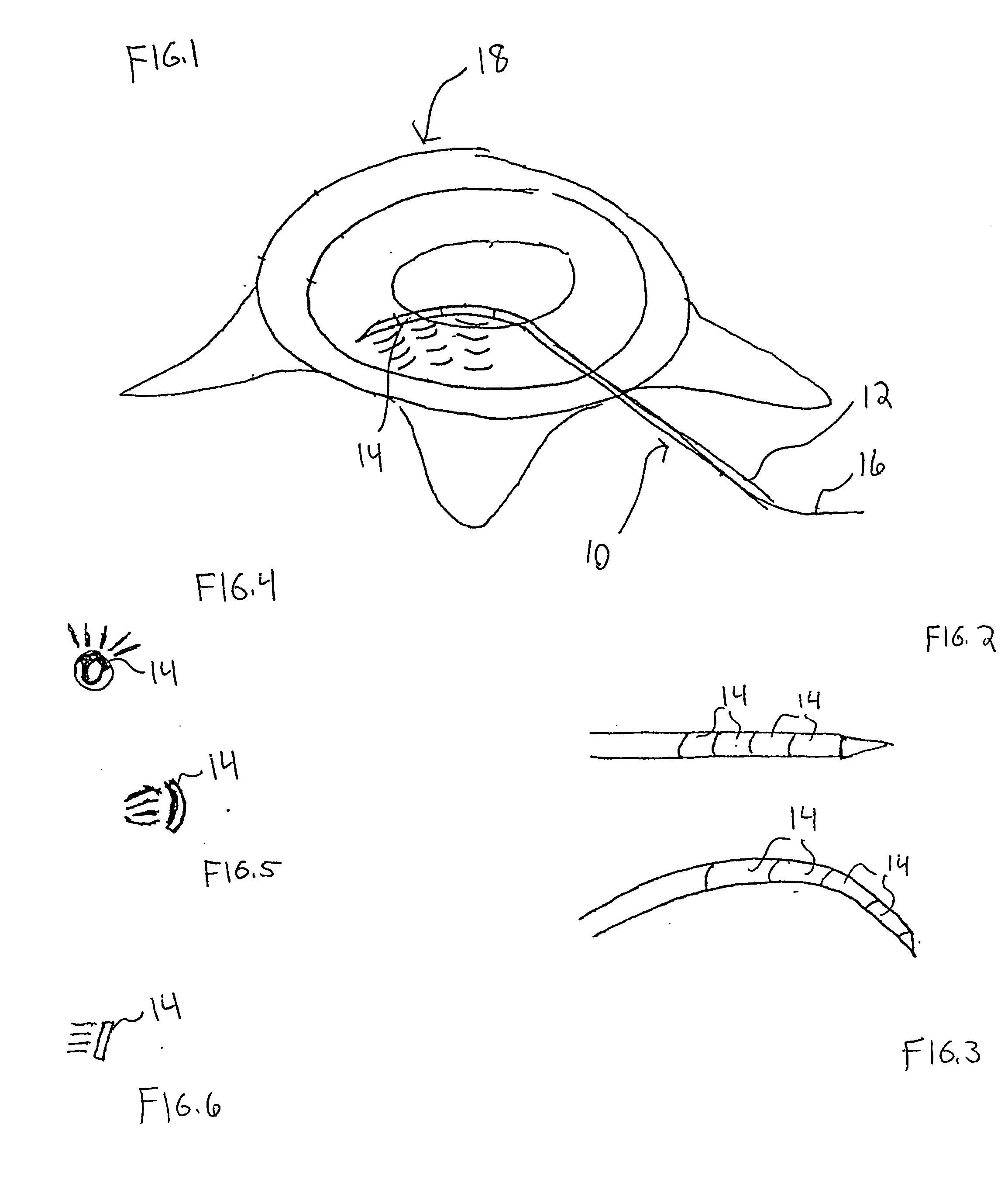 Ultrasound device for treatment of intervertebral disc