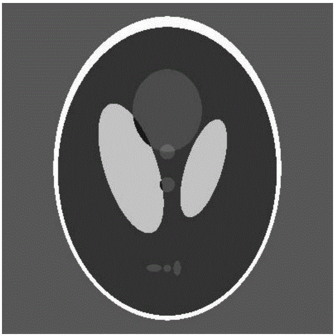 Medical ultrasonic image de-noising method based on normal inverse Gaussian model