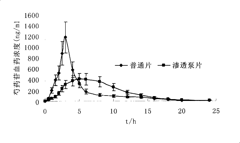 Finely prepared controlled release preparation for coronary disease and its preparation process