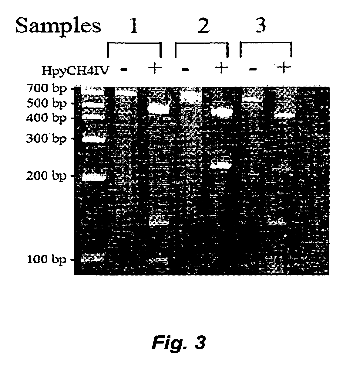 Methods for determining glutathione S-transferase theta-1 genotype