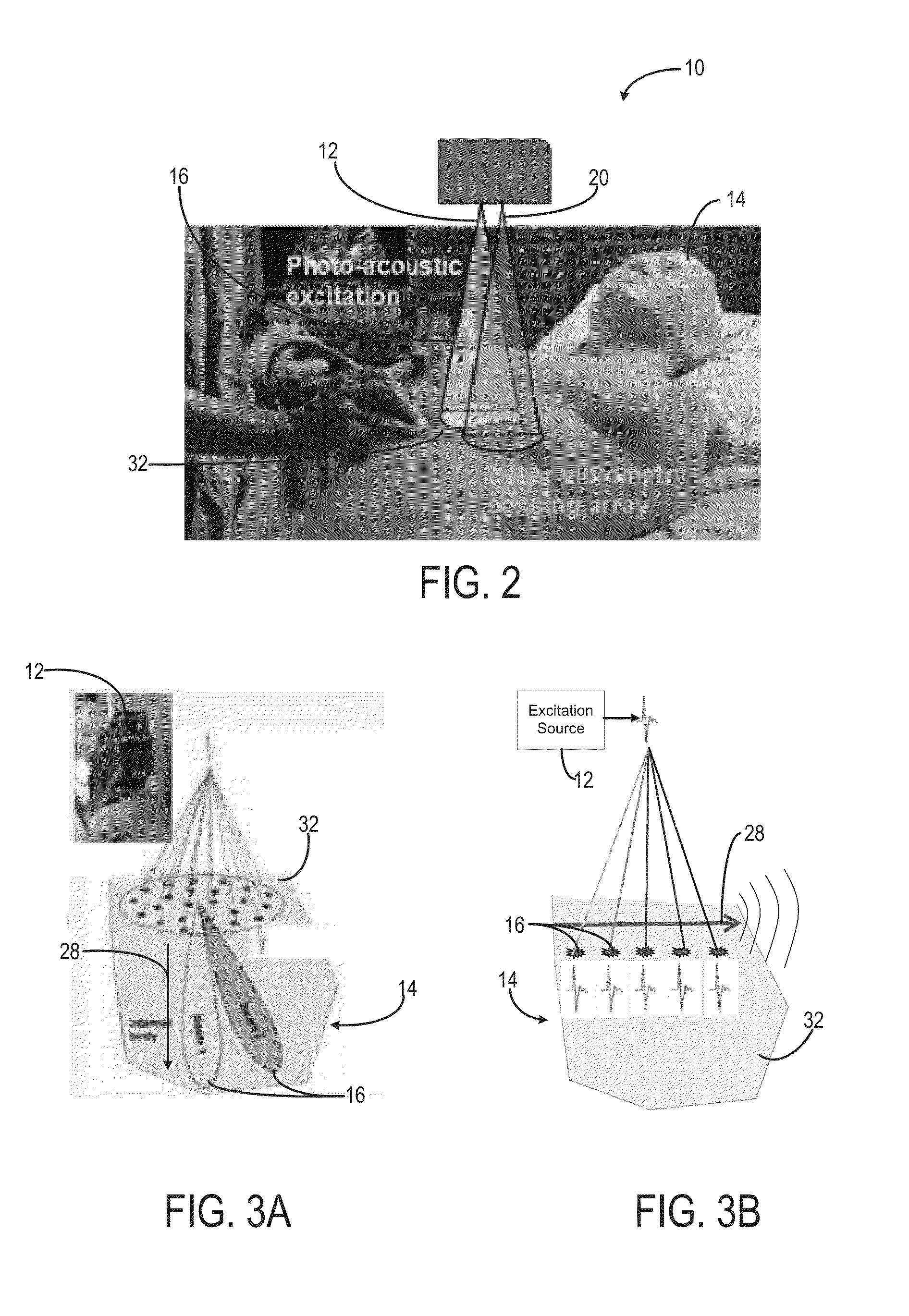 System and method for non-contact ultrasound