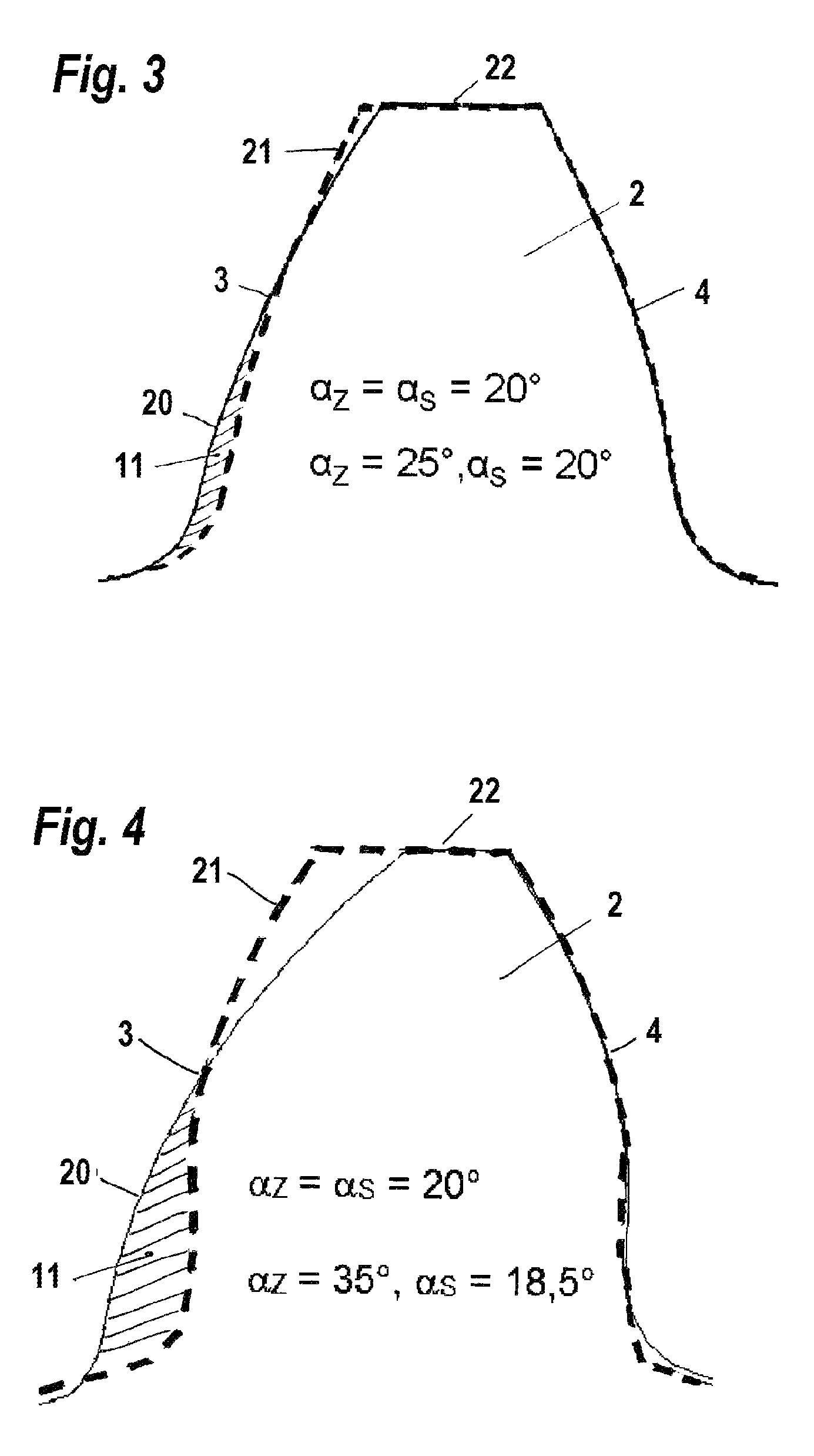 Load rating optimized bevel gear toothing