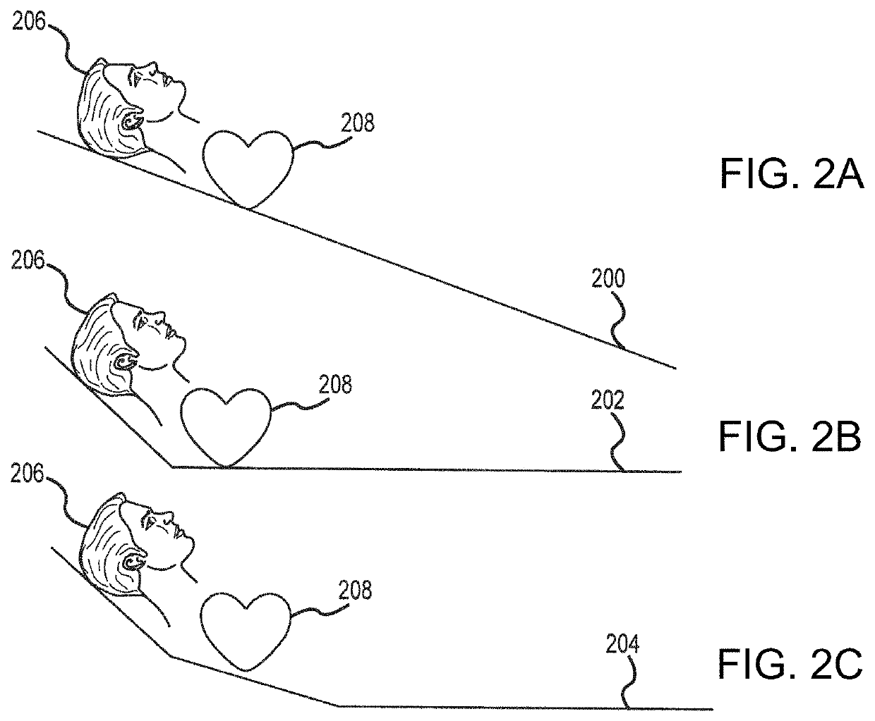 Systems and methods for improved post-resuscitation recovery