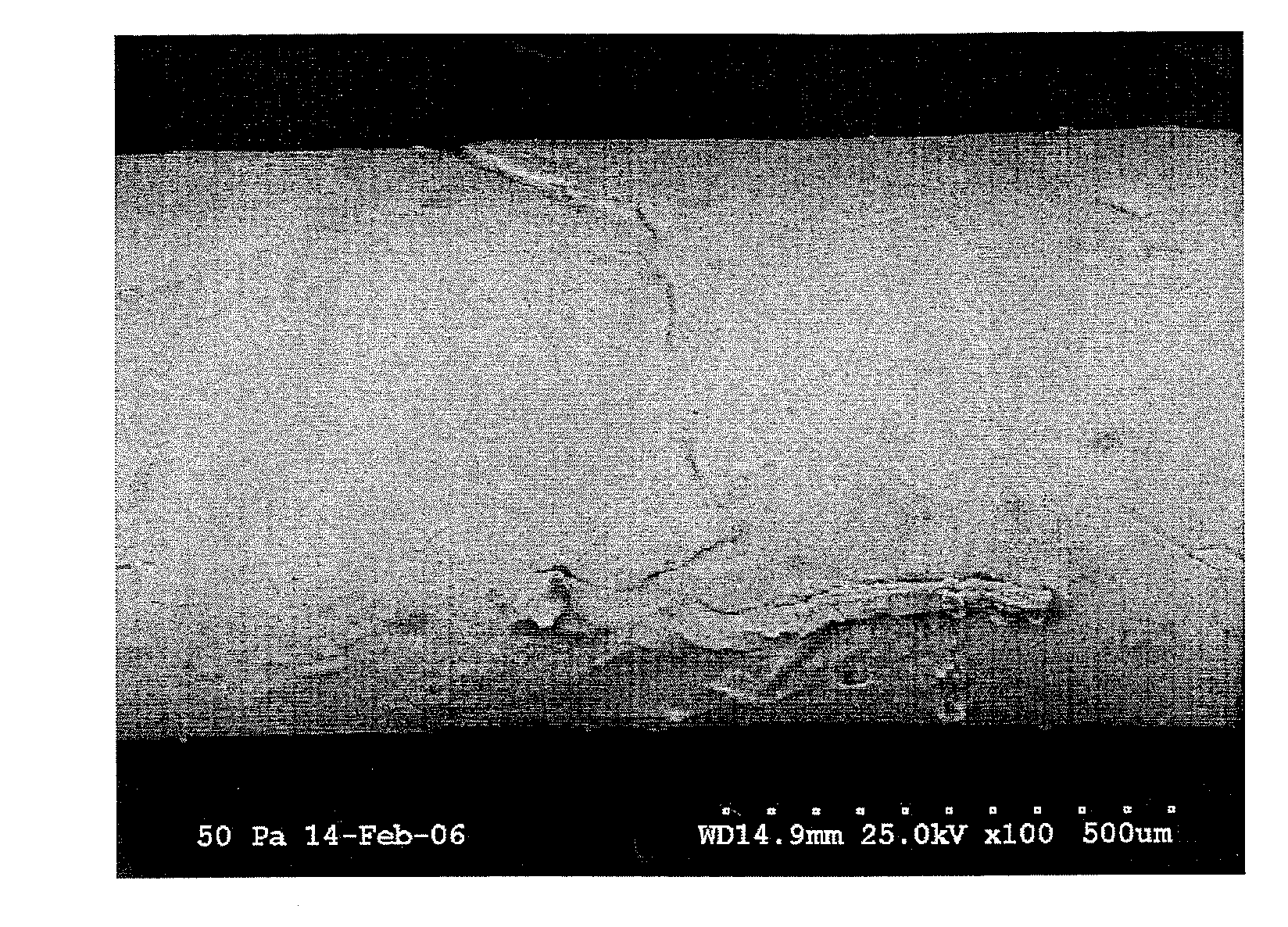 Urological devices incorporating collagen inhibitors