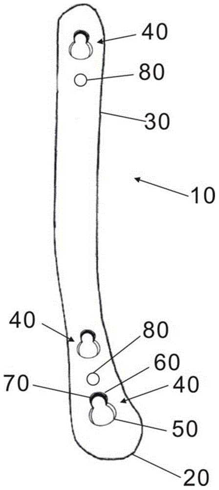 Proximal femur locking bone fracture plate