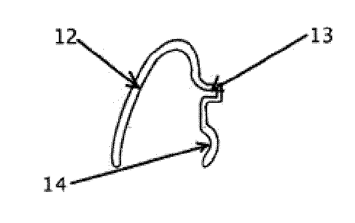 Removable lingual-vestibular dental alignment device and method for the production thereof