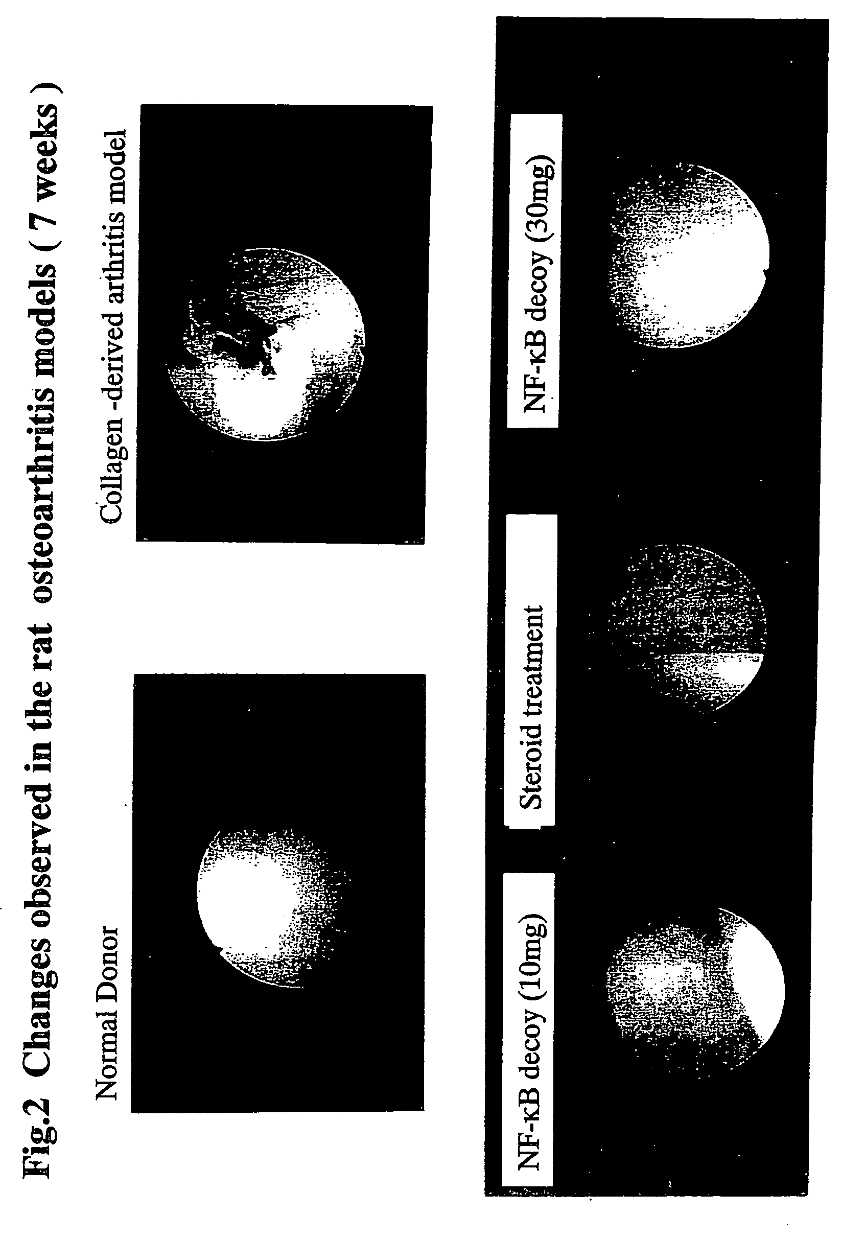 Decoy composition for treating and preventing inflammatory disease