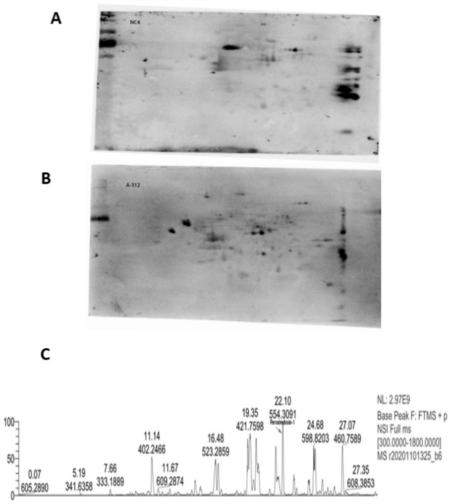 Kit for detecting anti-peroxiredoxin-1-IgG antibody