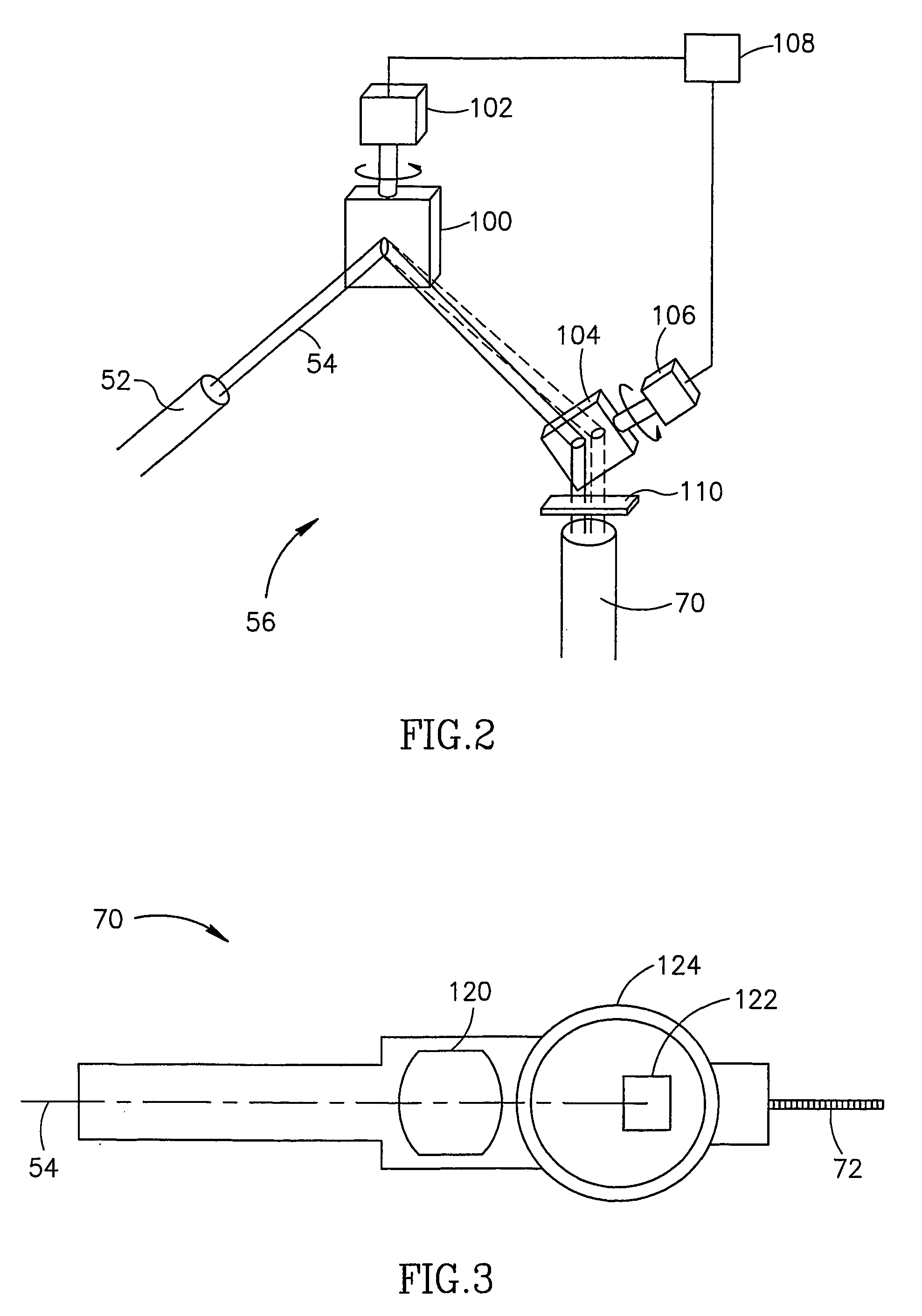 Non-penetrating filtration surgery