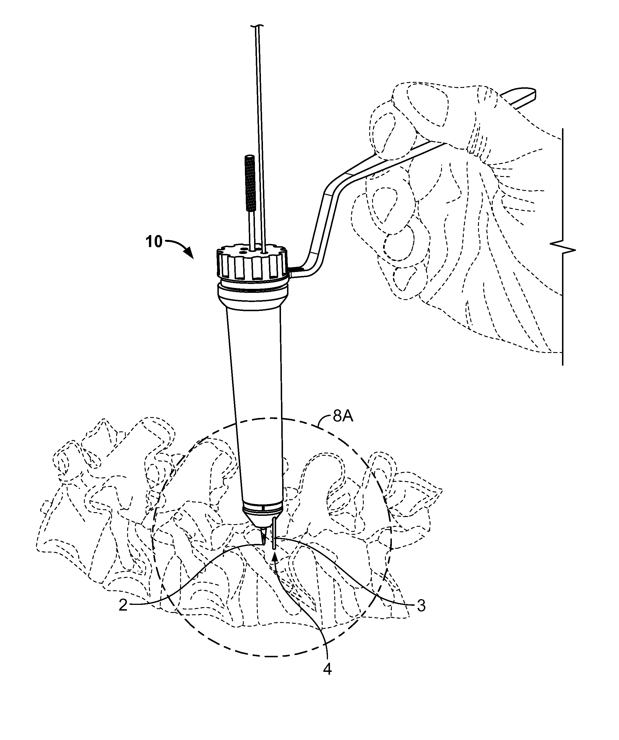 Pedicle drill guide for spinal surgery