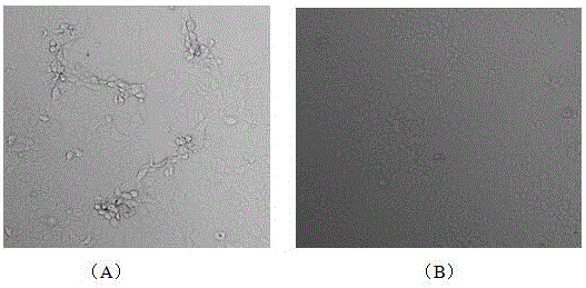 PEDV (porcine epidemic diarrhea virus), inactivated vaccine and preparation method of inactivated vaccine