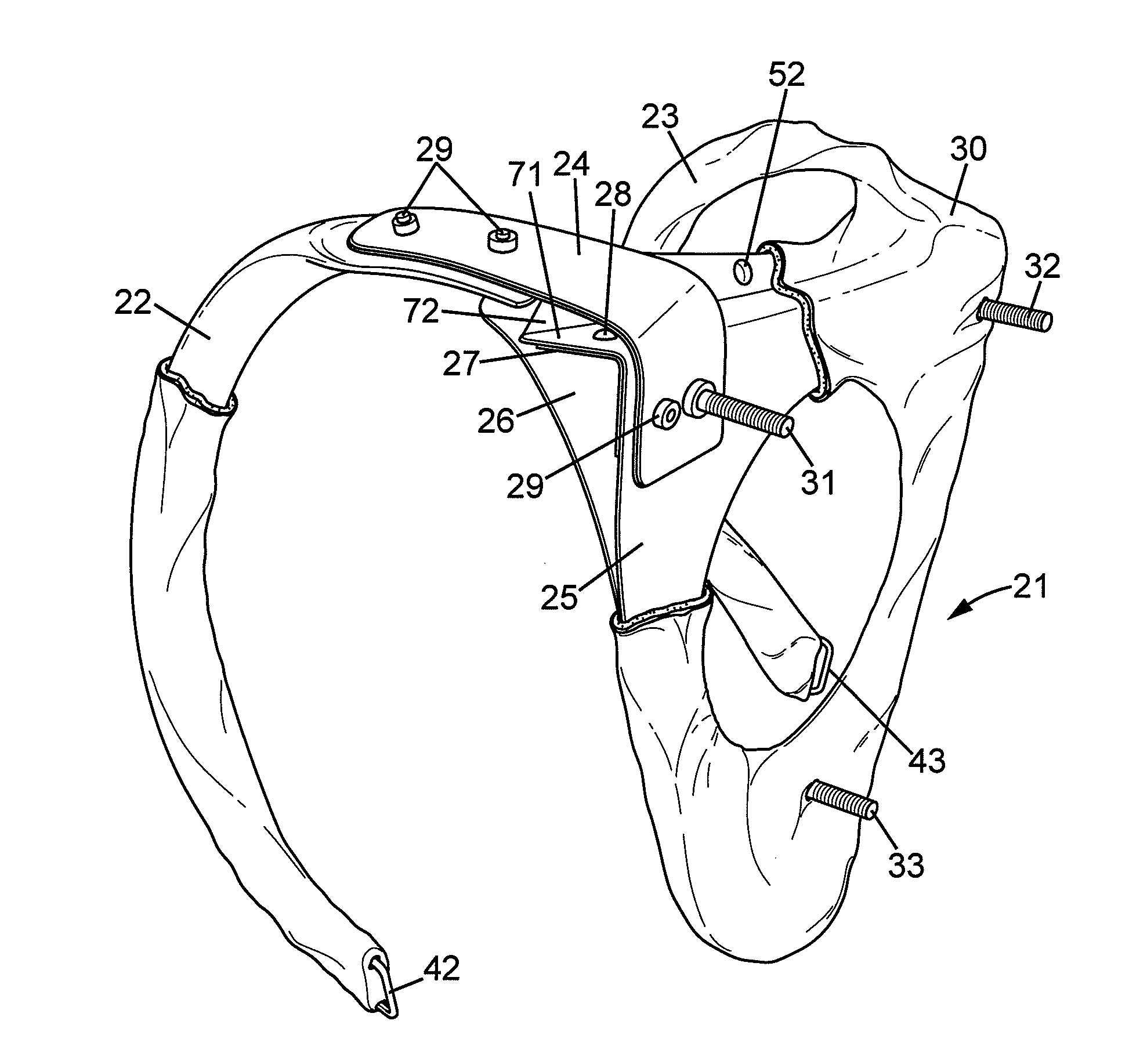 Prop-supporting harness for a stage performer