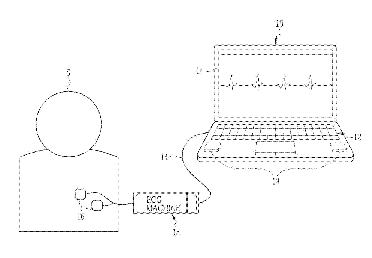 Diagnosis support apparatus, operating method, and non-transitory computer readable medium