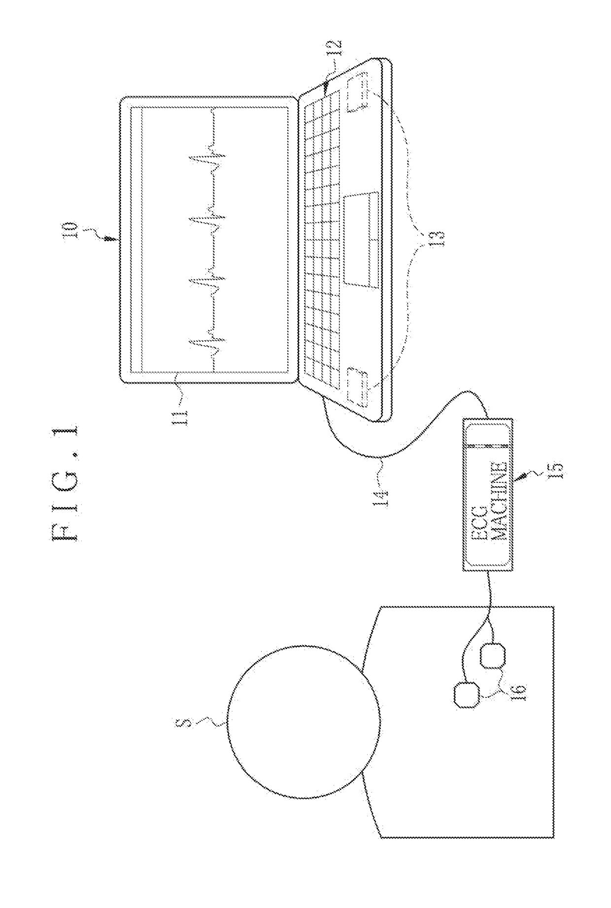 Diagnosis support apparatus, operating method, and non-transitory computer readable medium