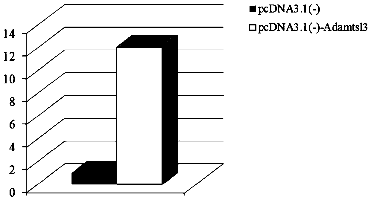 Application of Adamtsl3 as diagnosis and treatment marker for abdominal aortic aneurysm