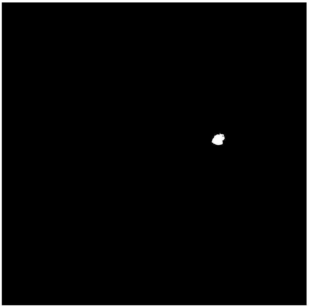 Glaucoma image recognition method, glaucoma image recognition equipment and screening system