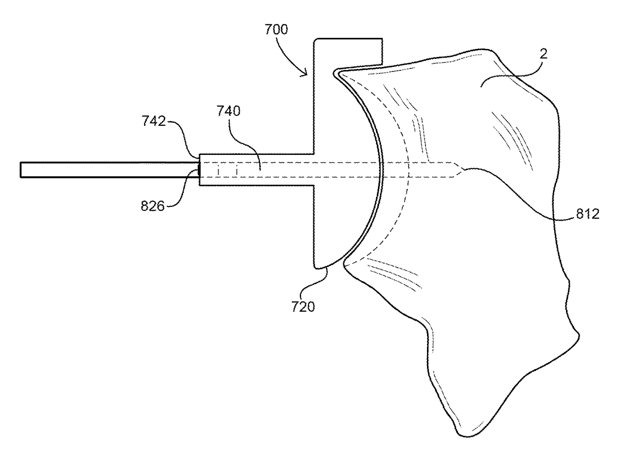 Shape-fit glenoid reaming systems and methods