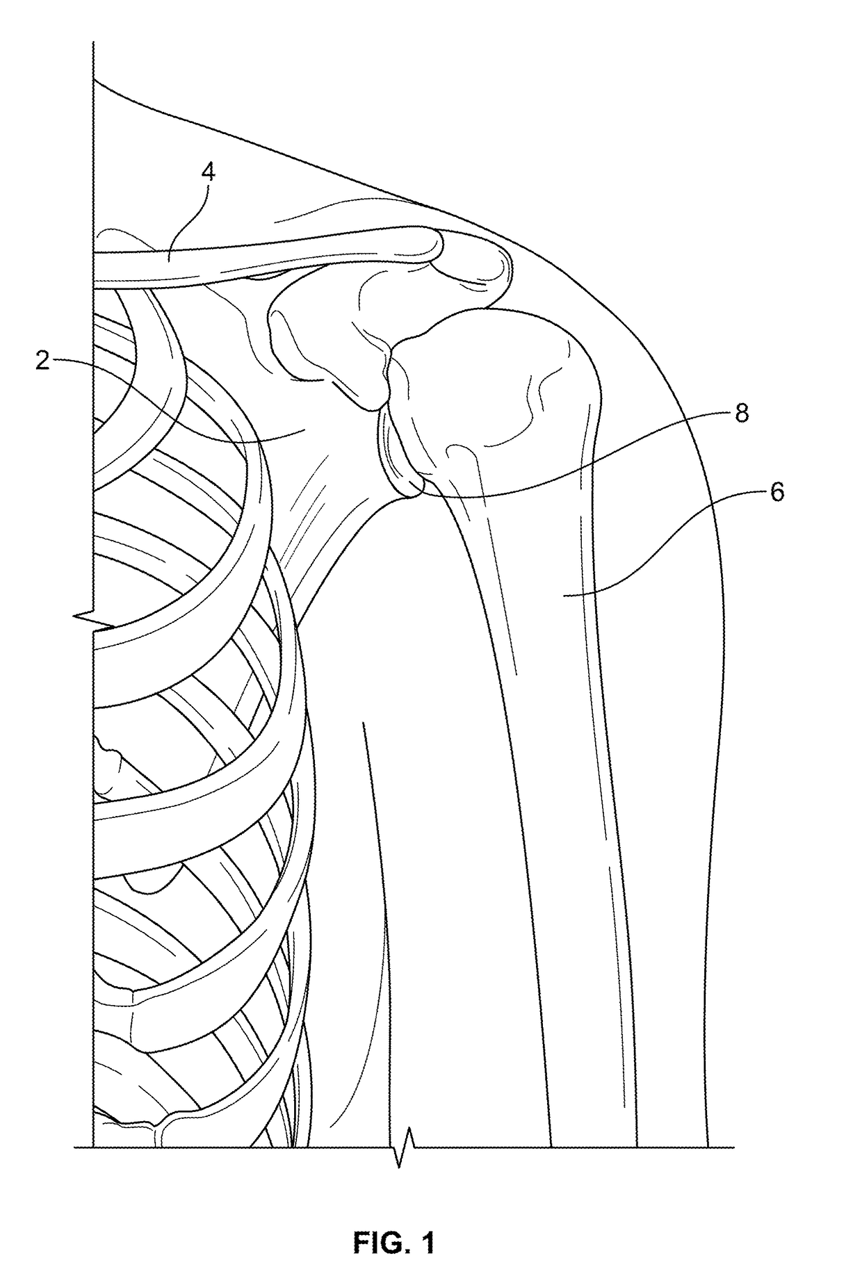 Shape-fit glenoid reaming systems and methods