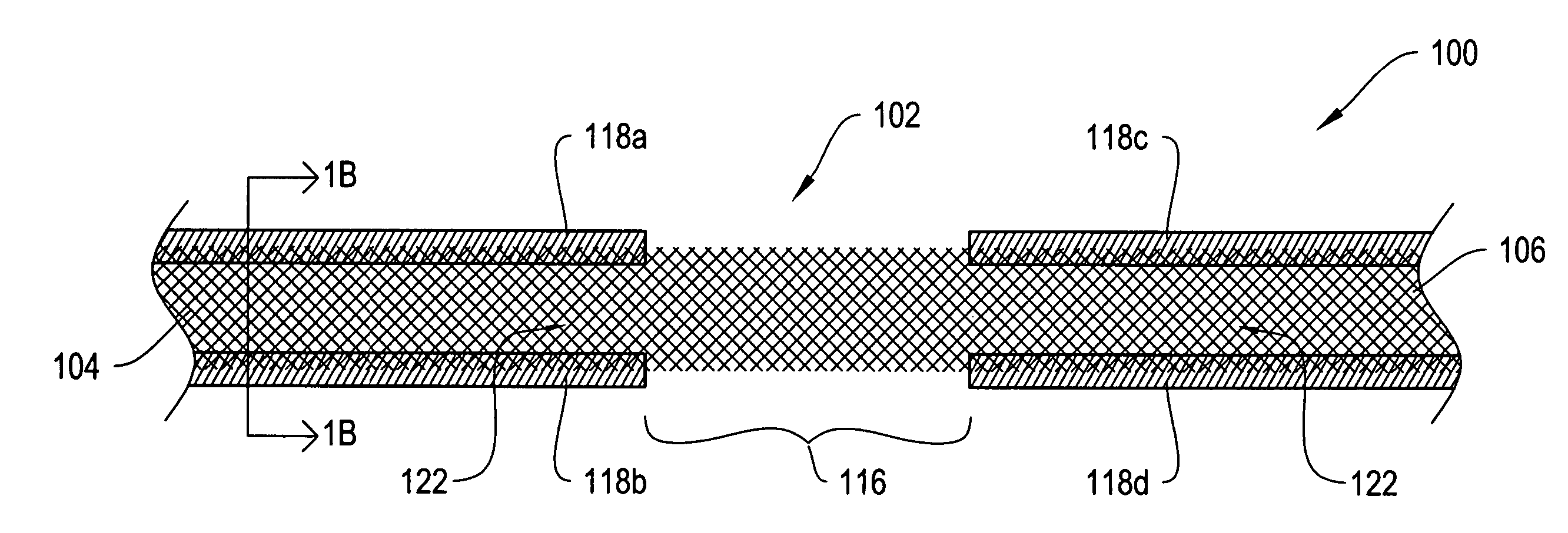 Dissolvable protective treatment for an implantable supportive sling