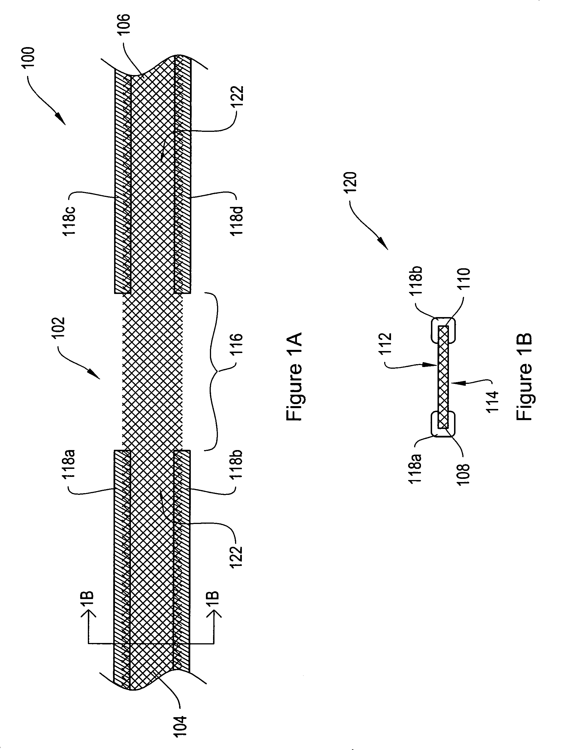 Dissolvable protective treatment for an implantable supportive sling