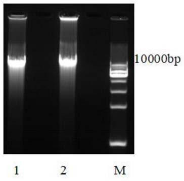 A gene recombinant Saccharomyces cerevisiae with detoxification function and its construction method and application