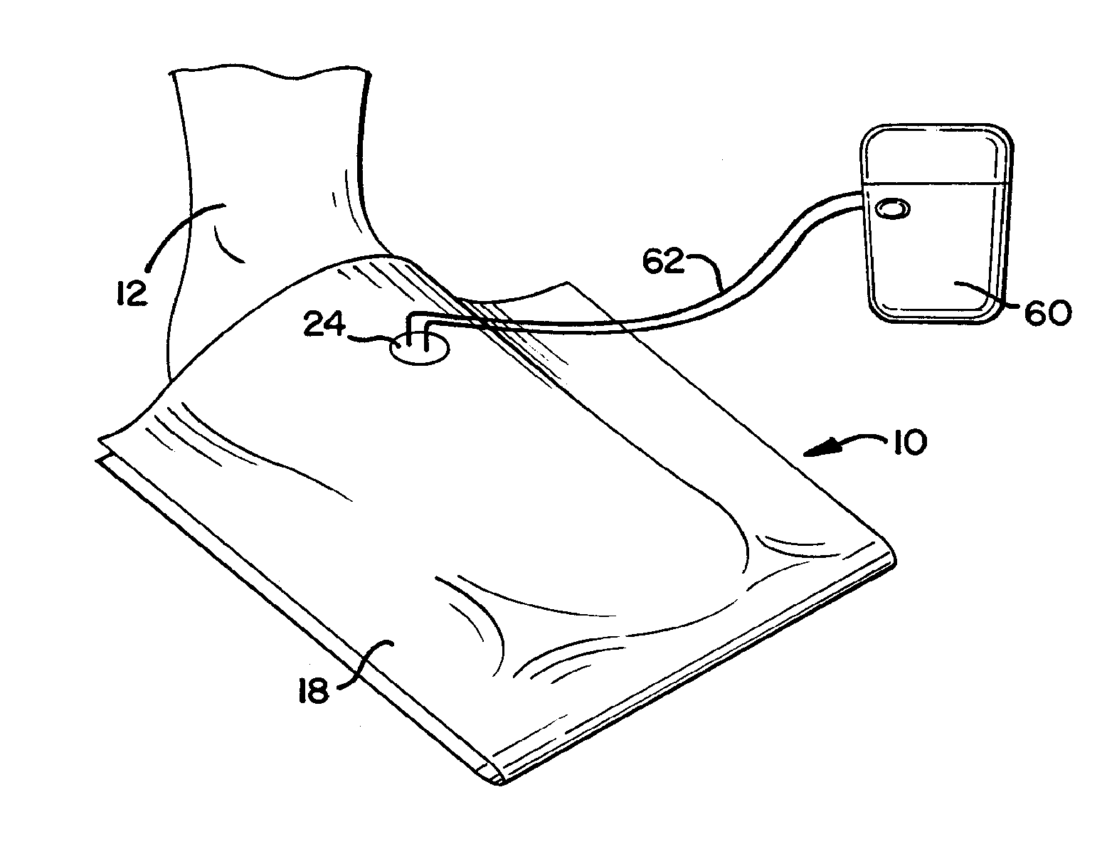 Negative Pressure Wound Therapy Device