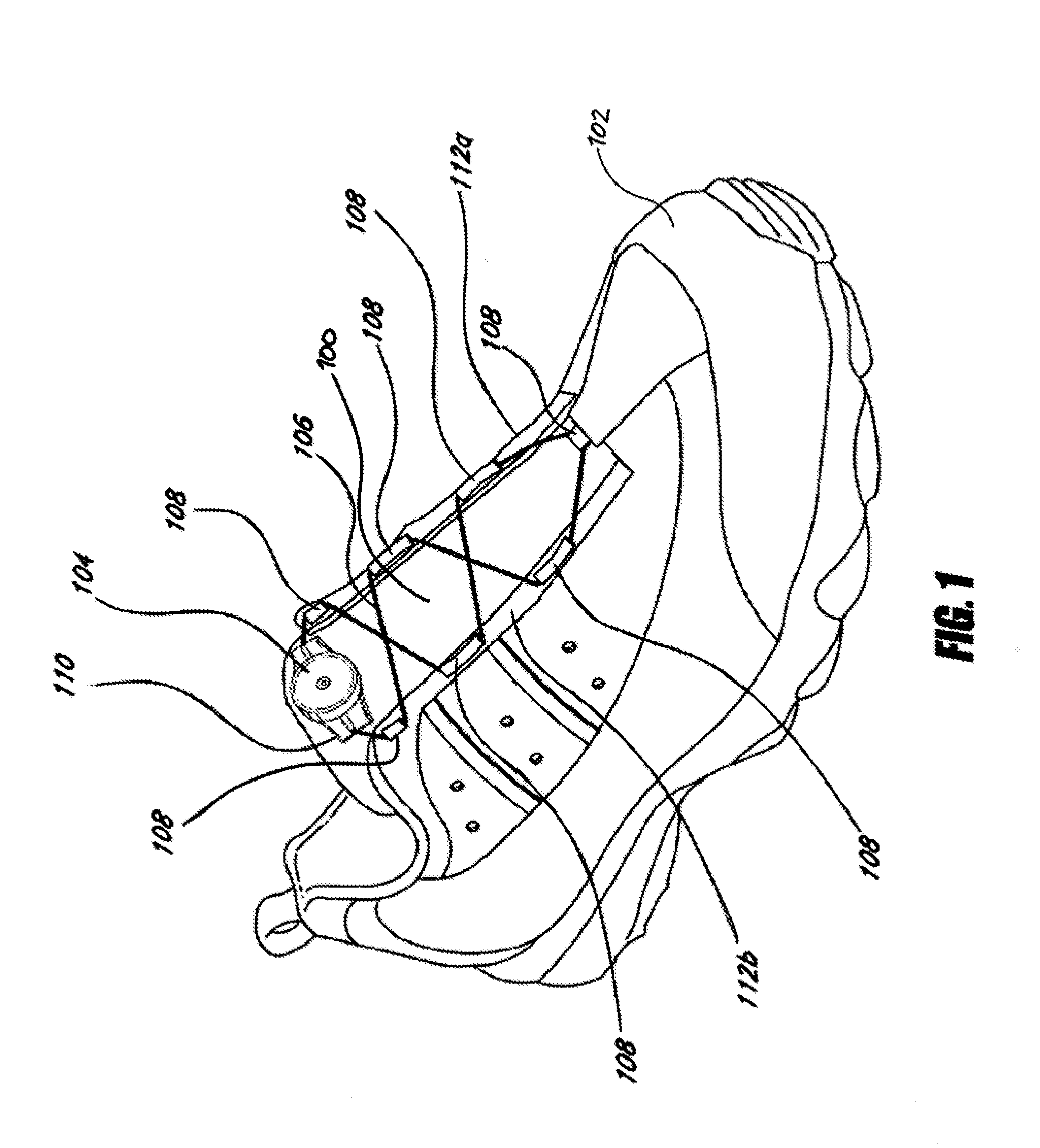 Guides and components for closure systems and methods therefor