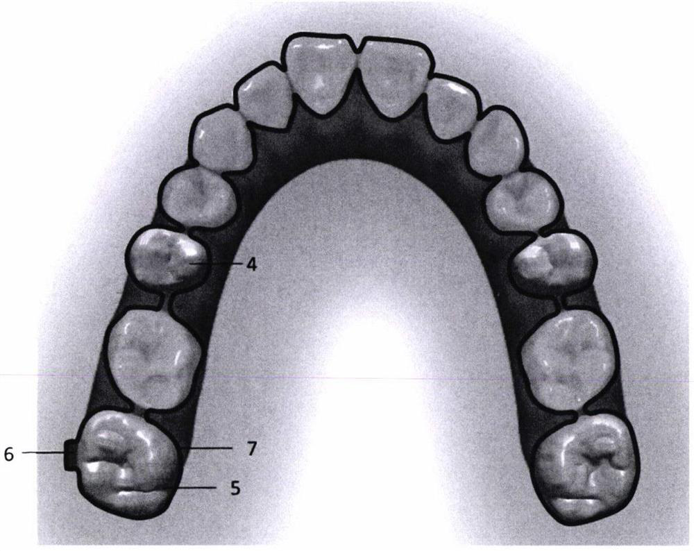 Bracket-free invisible orthodontic appliance produced based on tooth multi-position overlapping model and manufacturing method of bracket-free invisible orthodontic appliance