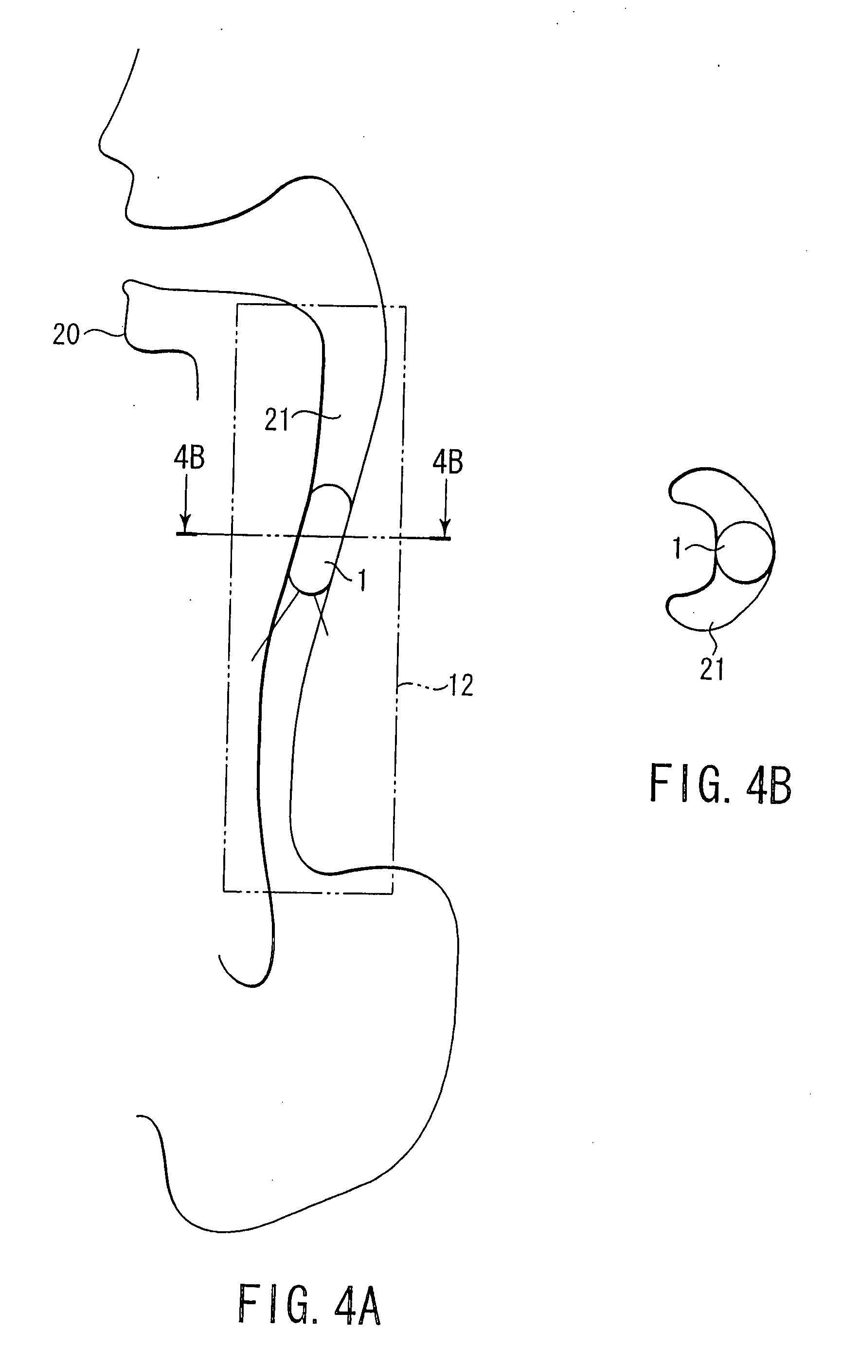 Capsule type endoscope