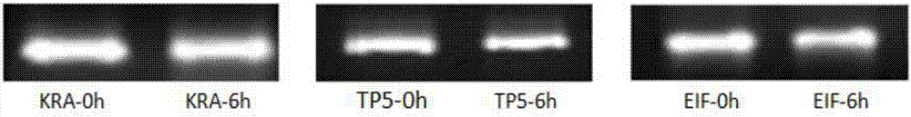 Oligonucleotide molecule used for inhibiting mRNA expression of VEGFA target gene and set composition thereof