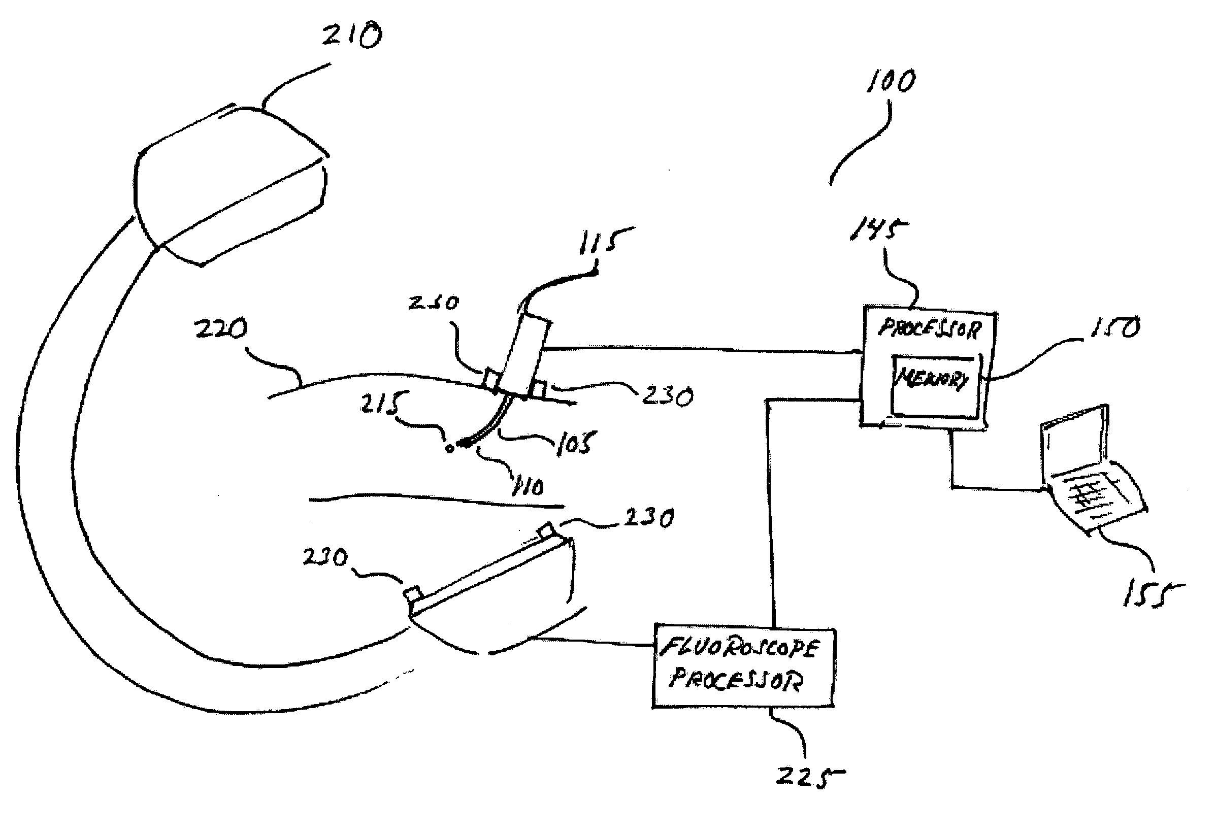 Distal bevel-tip needle control device and algorithm