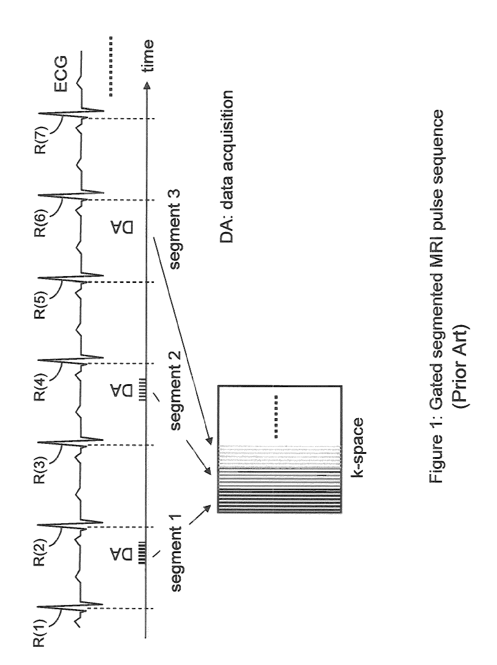 Long T1 artifact suppression techniques for magnetic resonance imaging