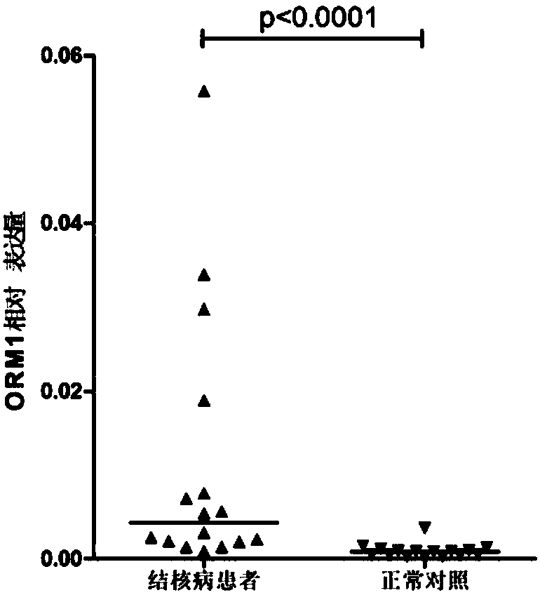 Application of system for detecting ORM1 (orosomucoid 1) gene expression quantity for diagnosing tuberculosis