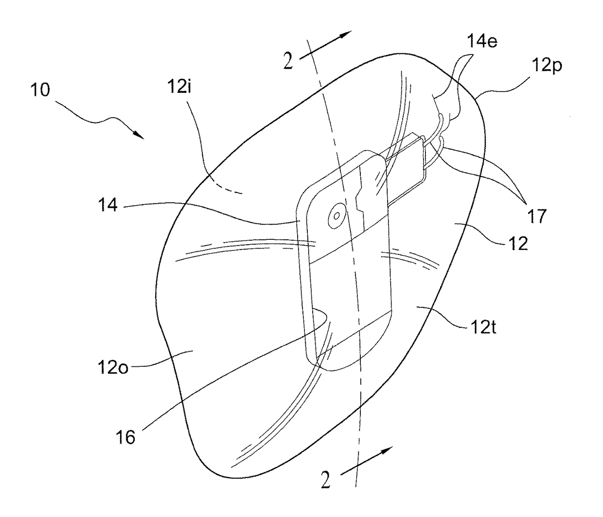 Method for manufacturing a low-profile intercranial device and the low-profile intercranial device manufactured thereby