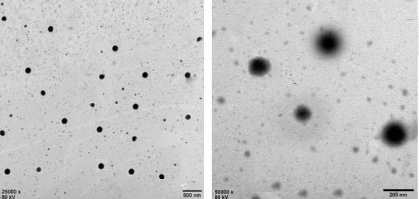 Budesonide flexible liposome temperature-sensitive gel and preparation method thereof