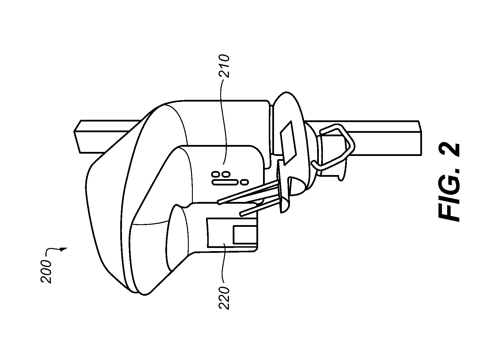 Method for producing teeth surface from x-ray scan of a negative impression