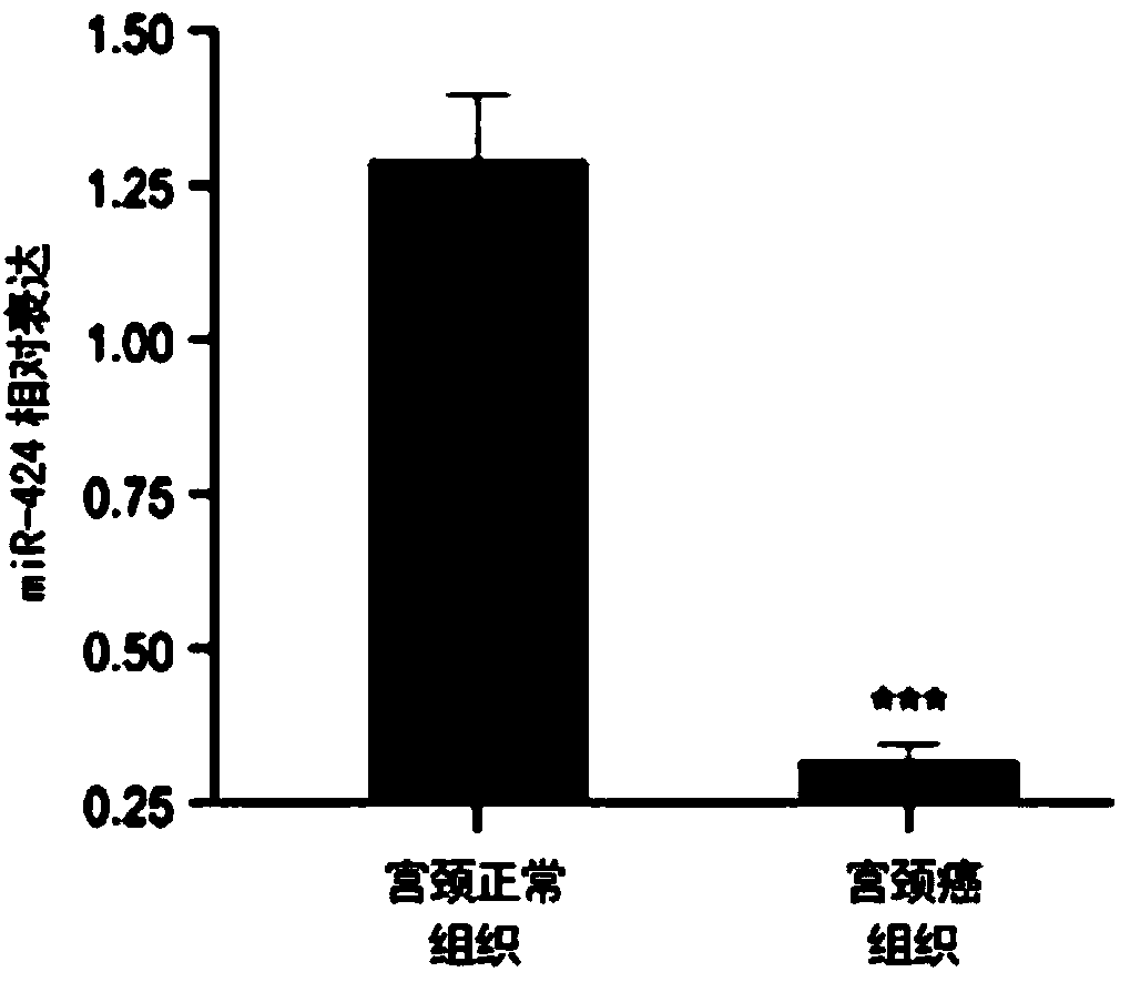 Application of microRNA in preparation of kit for diagnosis of cervical carcinoma or precancerous lesions