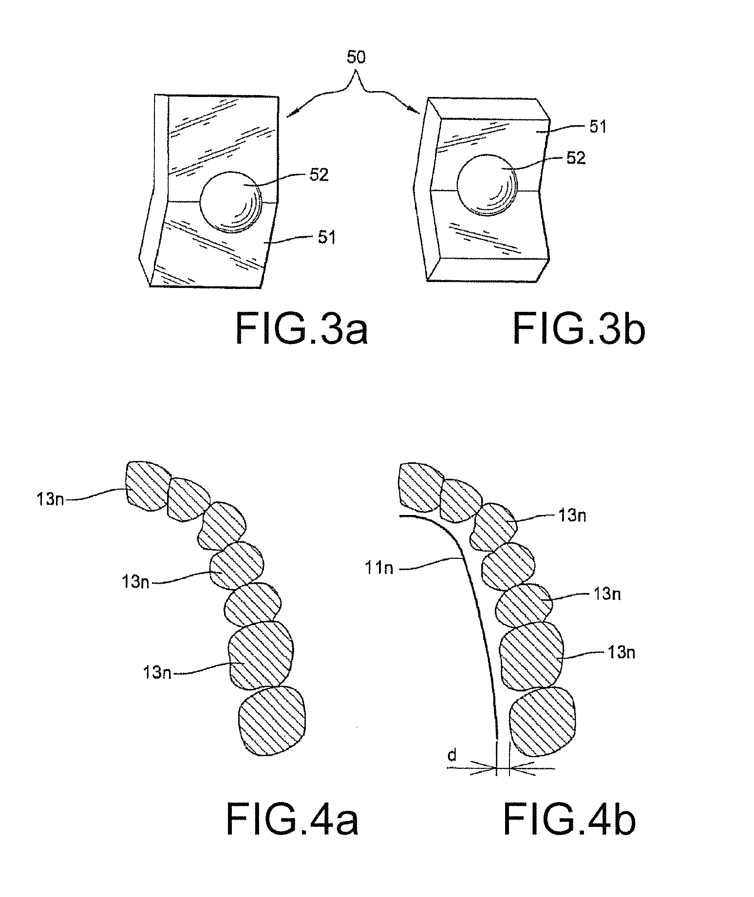 Method for producing a customized orthodontic appliance