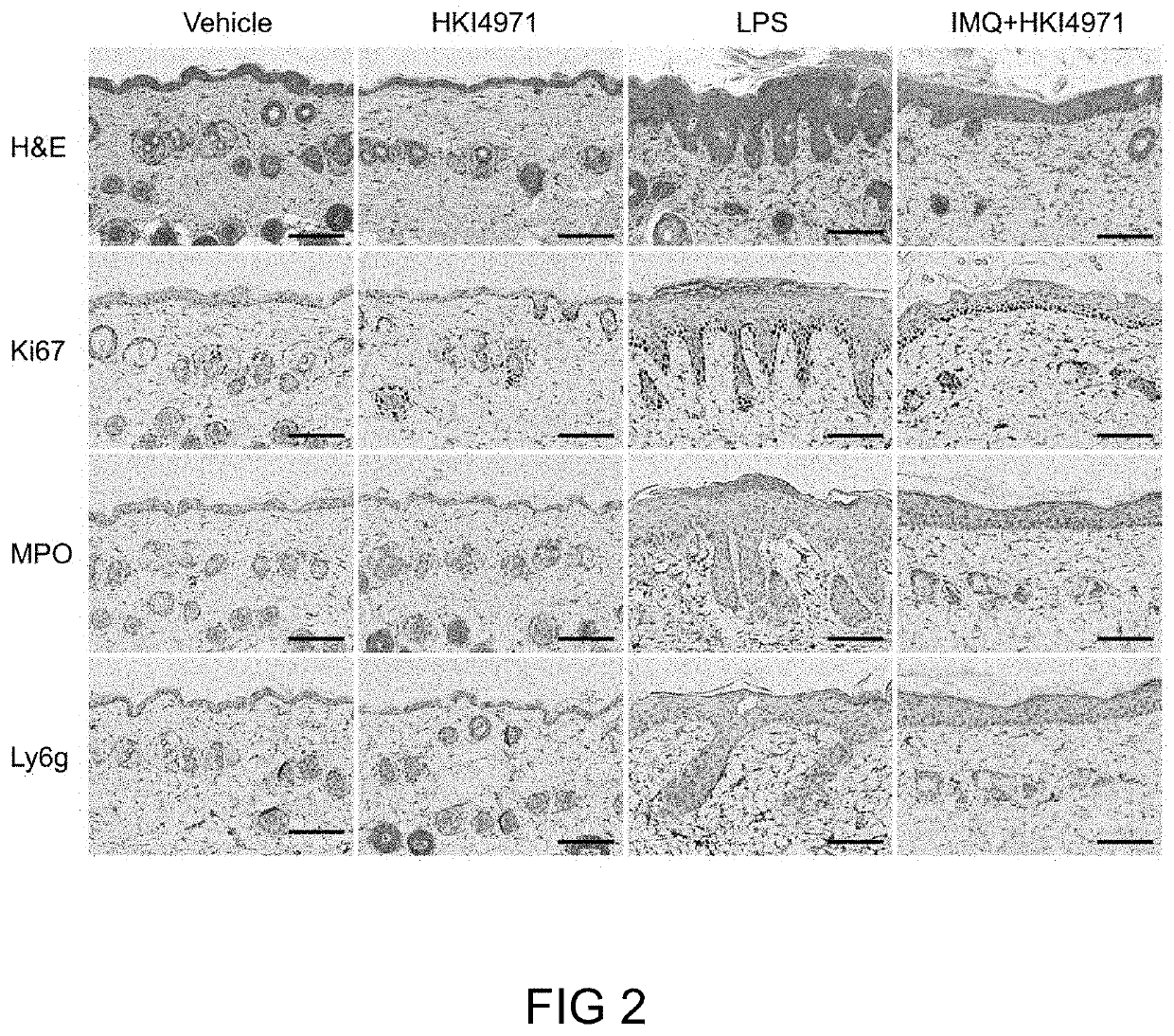 Neutrophil inflammation inhibitor and uses thereof