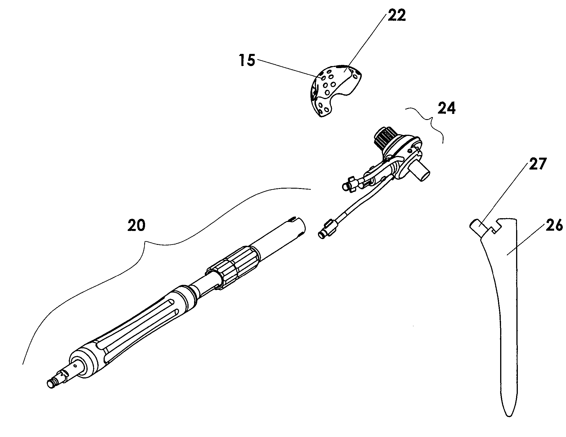 Apparatus and method for minimally invasive total joint replacement