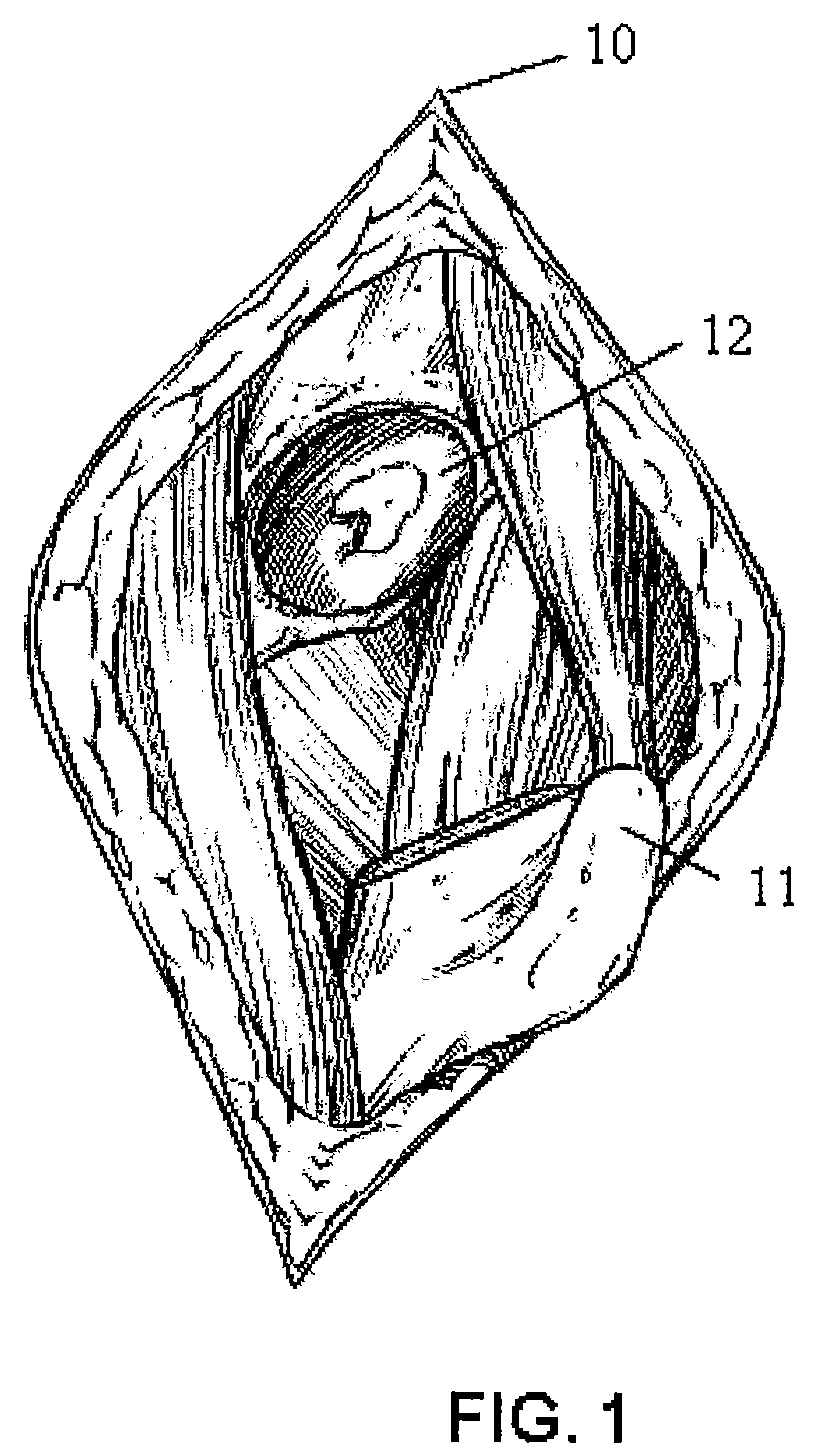 Apparatus and method for minimally invasive total joint replacement