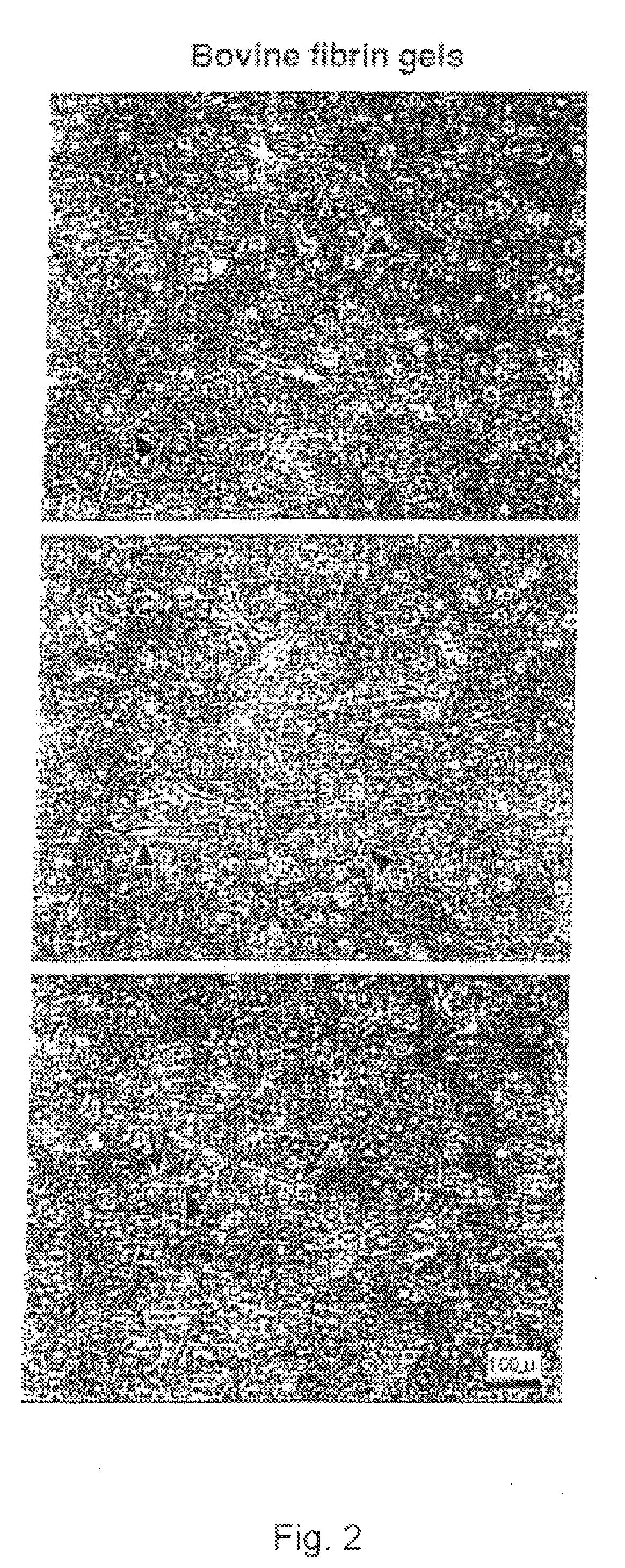 Method of Using Fish Plasma Components to Inhibit Glial Scarring and Promote Functional Recovery in the Mammalian CNS